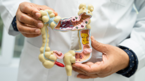 medical cannabis and gastrointestinal disorders